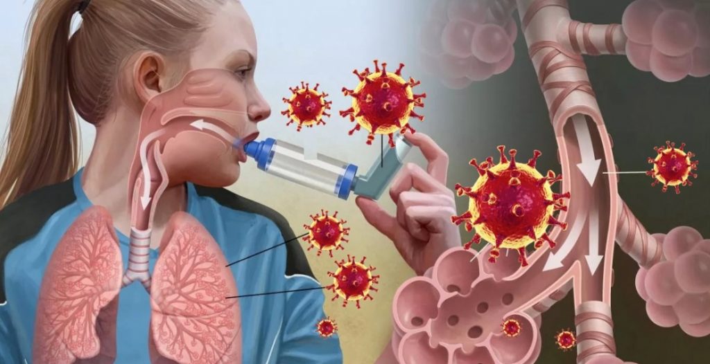 Чем опасен коронавирус при астме